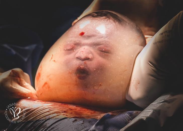 Adorable Baby Boy Born En Caul, Inside A Bubble Captured Into Amazing Photographs