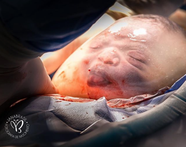 Adorable Baby Boy Born En Caul, Inside A Bubble Captured Into Amazing Photographs