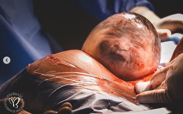 Rare moment Adorable Baby Boy Born En Caul, Inside A Bubble Captured Into Amazing Photographs