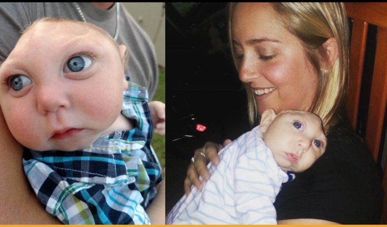 Baby Born With Just 20% Of Brain Proves To Be A ‘Miracle Child’ Outliving Doctors’ Expectations