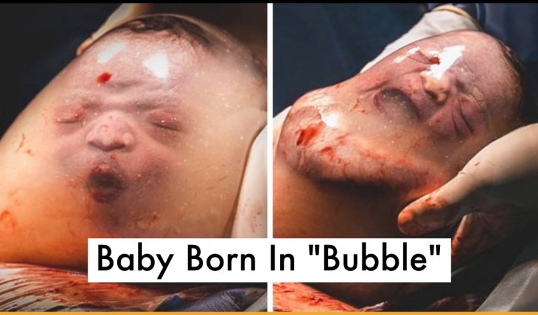 Incredibly Rare Moment Baby Born In “Bubble” Captured In Stunning Photographs