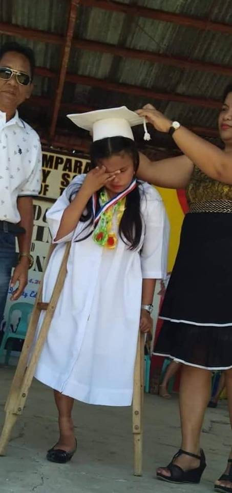 Girl With One Leg In Philippines Completed Her School By Walking, Becomes An Inspiration For Many