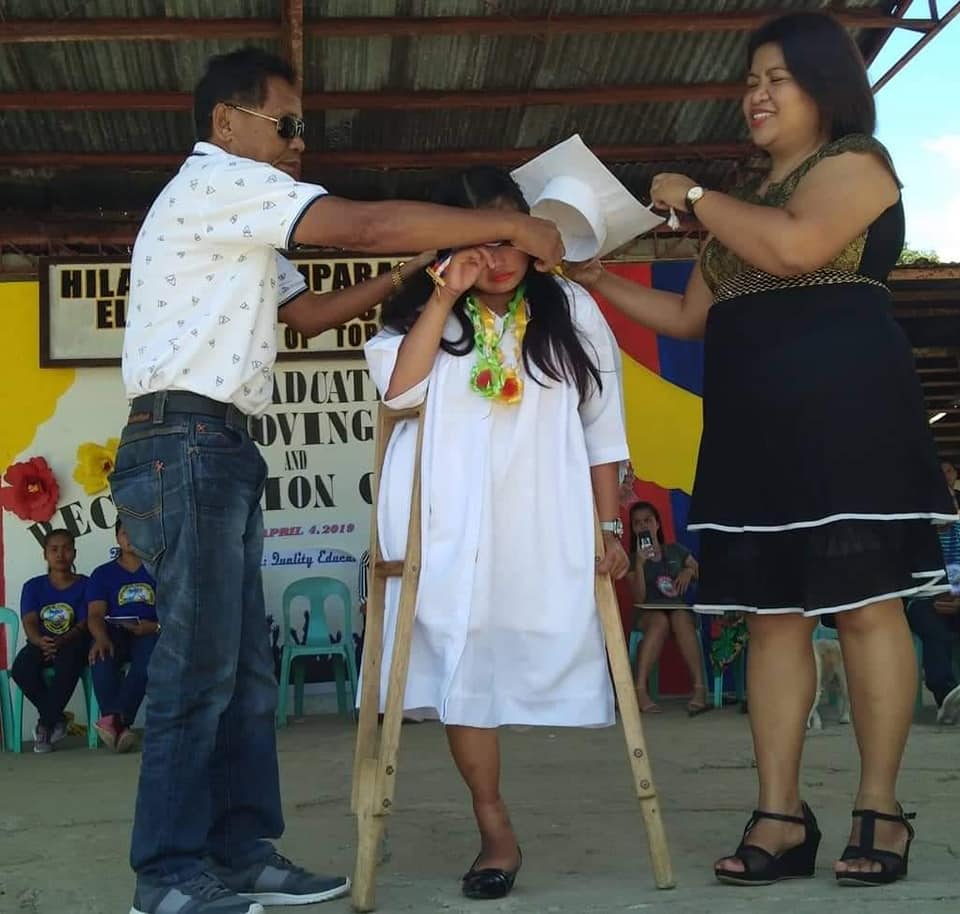 Girl With One Leg In Philippines Completed Her School By Walking, Becomes An Inspiration For Many