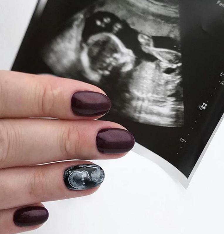 Ultrasound Nails Are The New Trend Among Pregnant Ladies