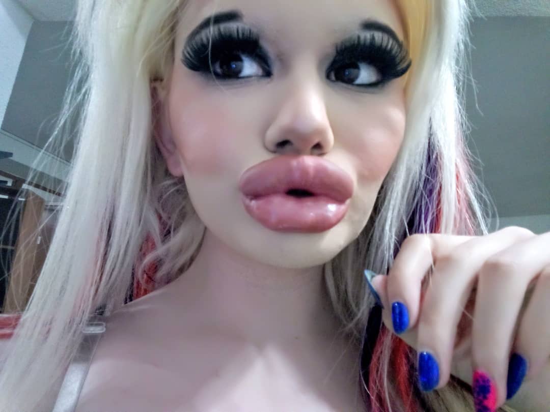 Bulgarian Woman Goes Through 15 Surgeries In A Year To Look Like Barbie