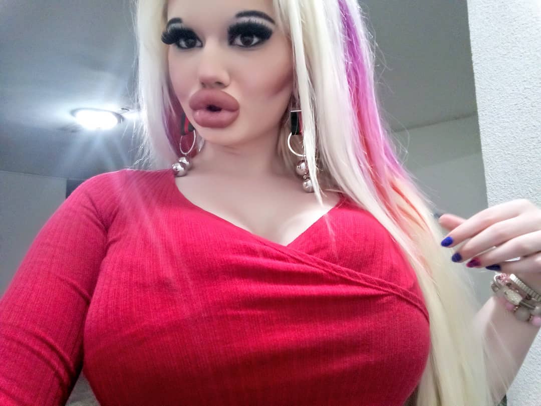 Bulgarian Woman Goes Through 15 Surgeries In A Year To Look Like Barbie