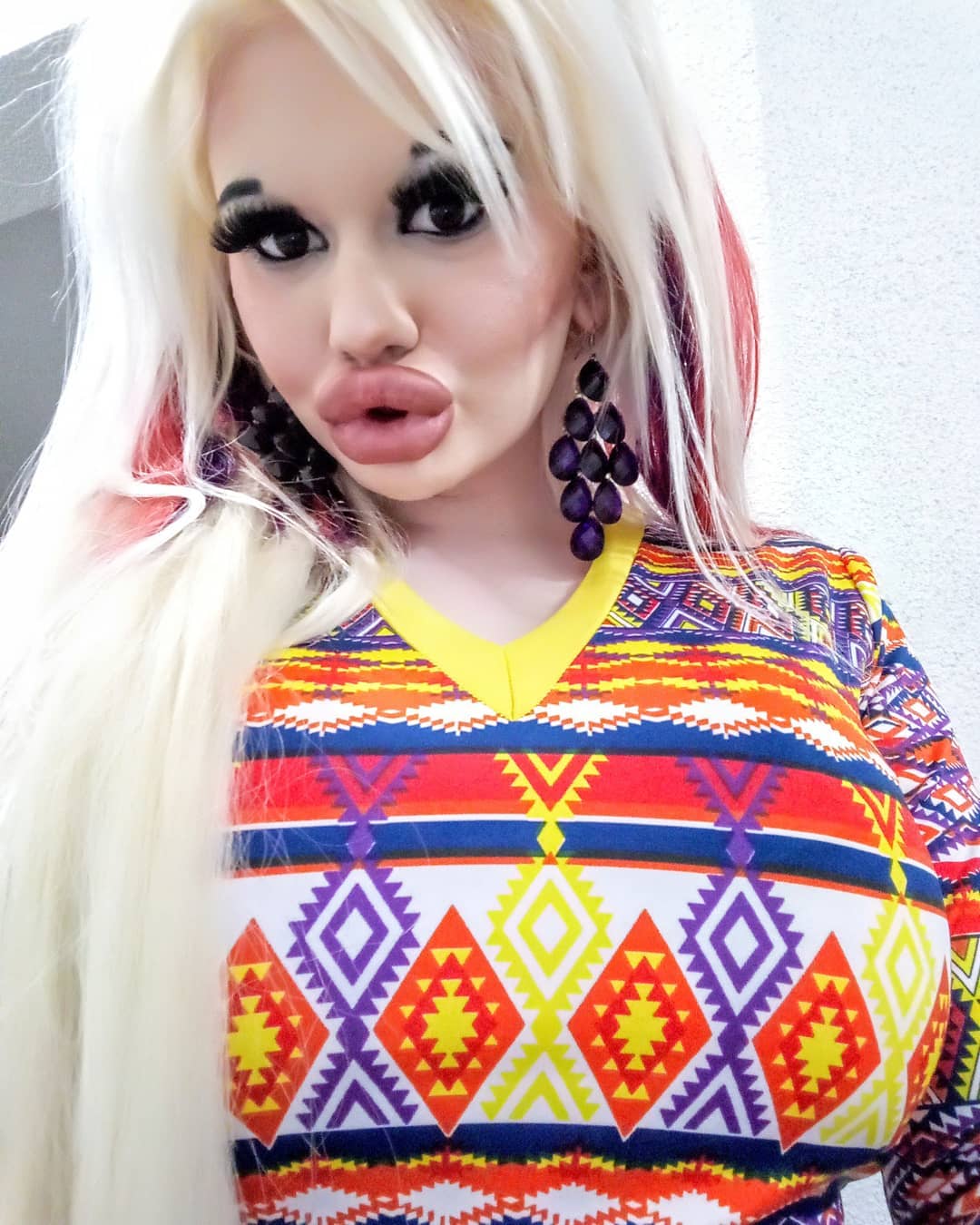 Bulgarian Woman Goes Through 15 Surgeries In A Year To Look Like Barbie