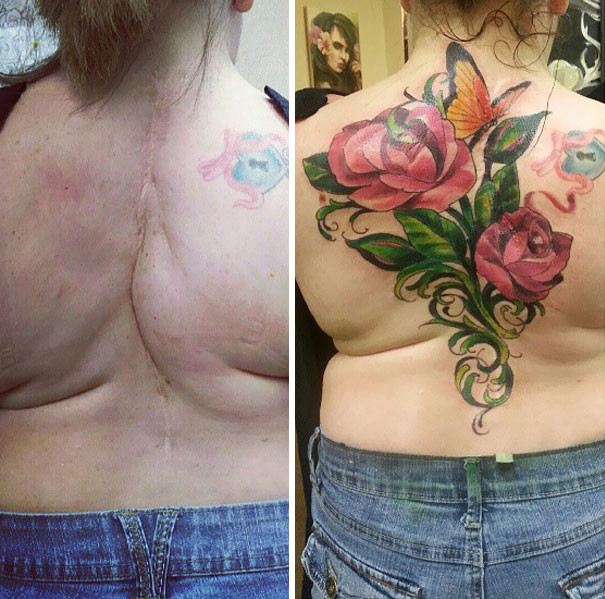 10 Best Scoliosis Surgery Scar Tattoo IdeasCollected By Daily Hind News   Daily Hind News