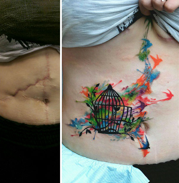  Tattoos Cover Up Scars