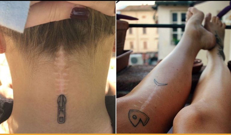 These Tattoos Cover Up Scars In The Best Possible Way And Its Just Too Good