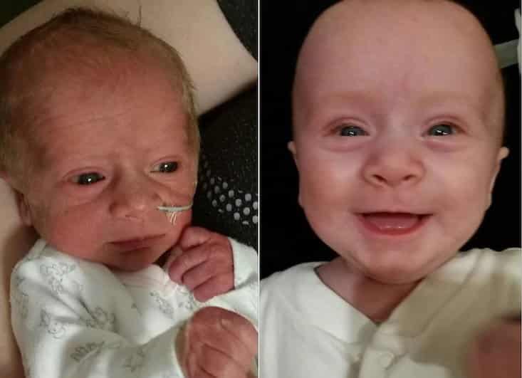 adorable picture of premature babies smiling