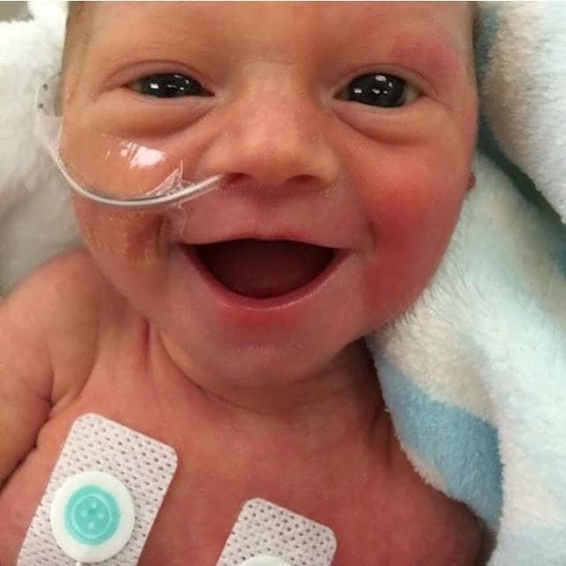 adorable pcitures of premature babies smiling
