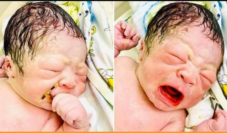 Picture Of A New-born Baby Holding Mother’s Birth-Preventing IUD Goes Viral
