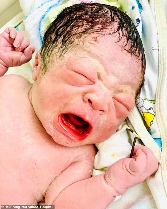 Picture Of A New-born Baby Holding Mother's Birth-Preventing IUD Goes Viral