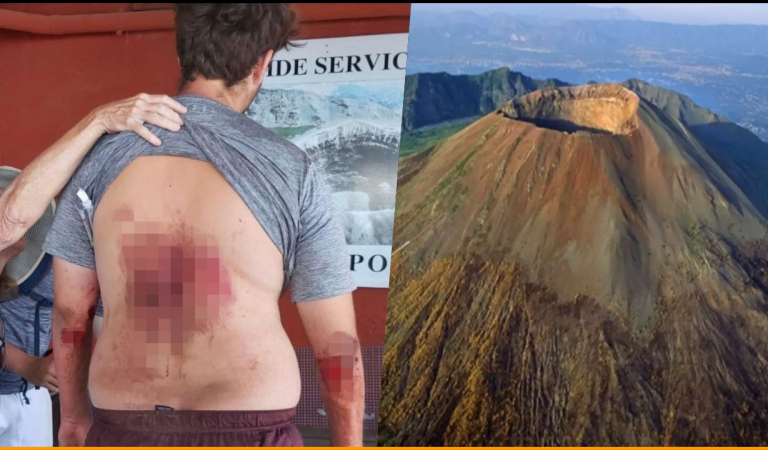 US Tourist Injured After He Fell Into Mount Vesuvius While Taking A Selfie