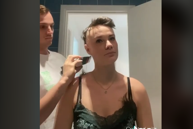 Boyfriend Shaves His Head For Girlfriend Suffering From Alopecia In Viral Video