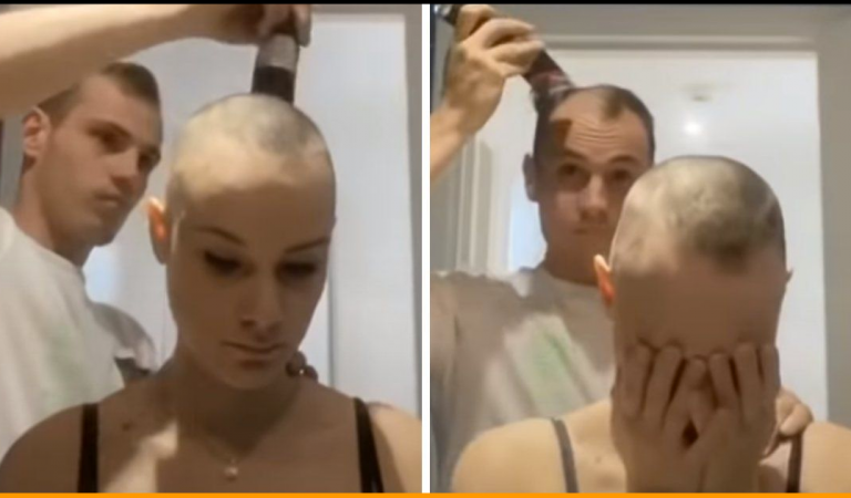 Boyfriend Shaves His Head For Girlfriend Suffering From Alopecia In Viral Video