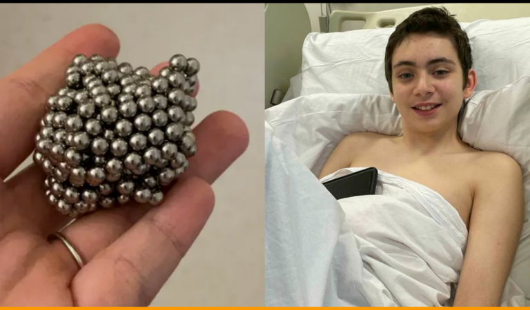 Boy Swallowed 54 Magnets to See If He’d Become Magnetic, Undergoes Emergency Operation